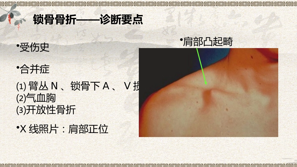 中医治疗：上肢骨折_第10页