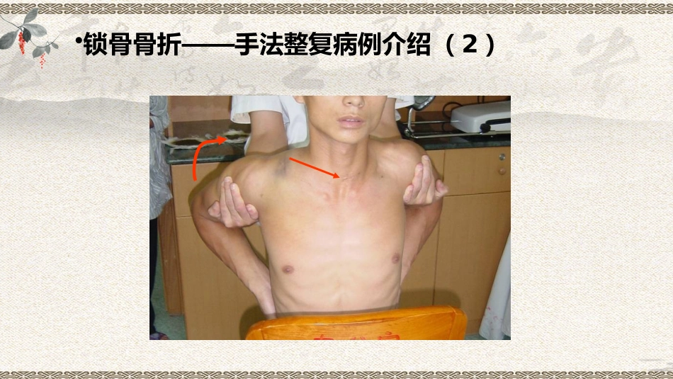 中医治疗：上肢骨折_第15页