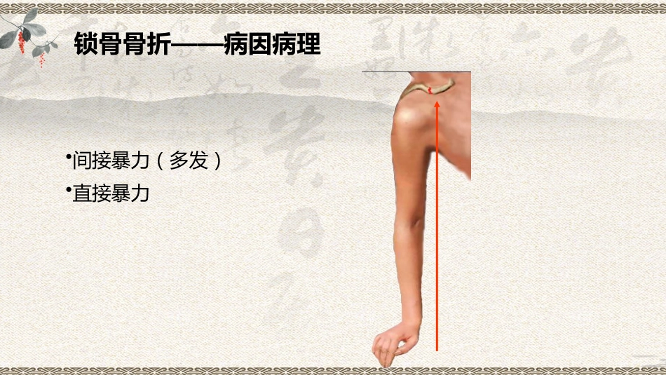 中医治疗：上肢骨折_第8页