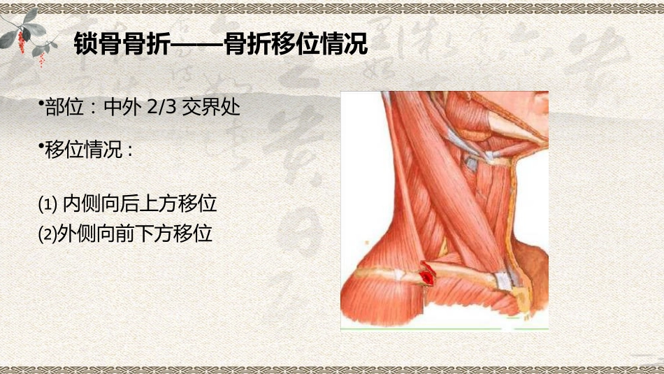 中医治疗：上肢骨折_第9页