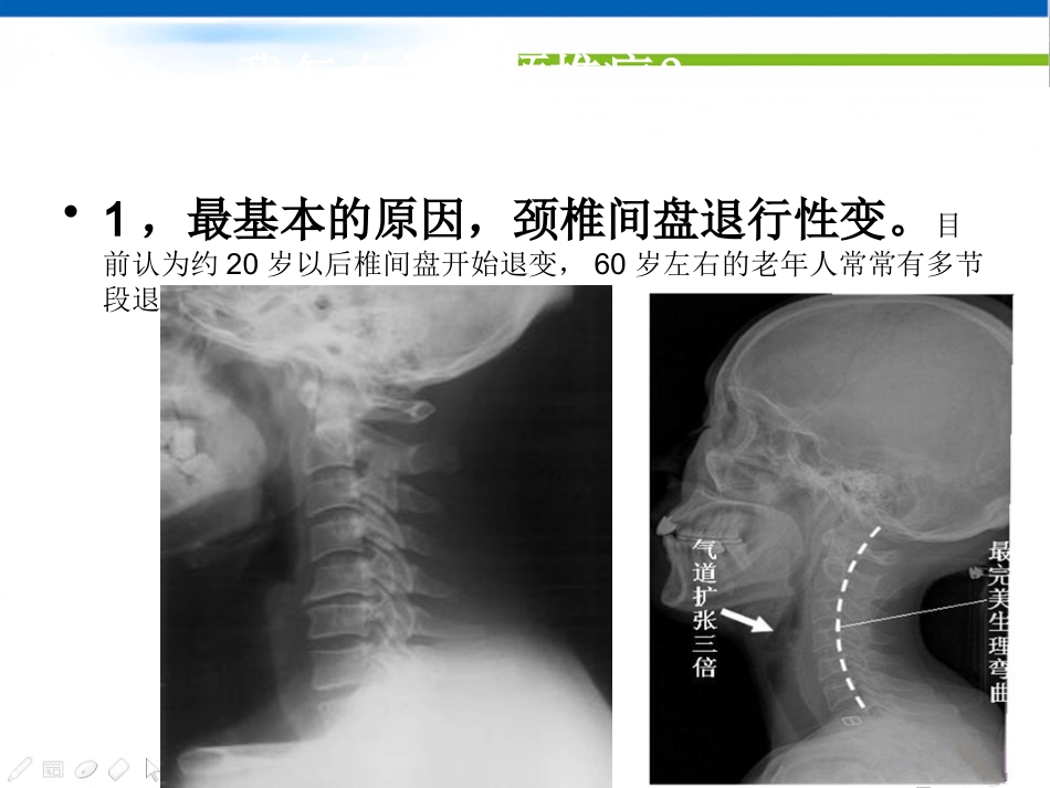 颈椎病的中医治疗方法_第3页