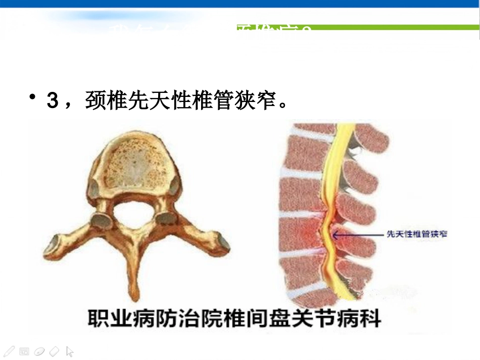 颈椎病的中医治疗方法_第5页