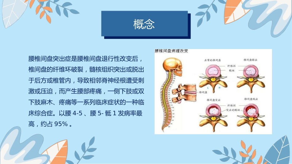 中医护理：腰椎间盘突出症_第4页
