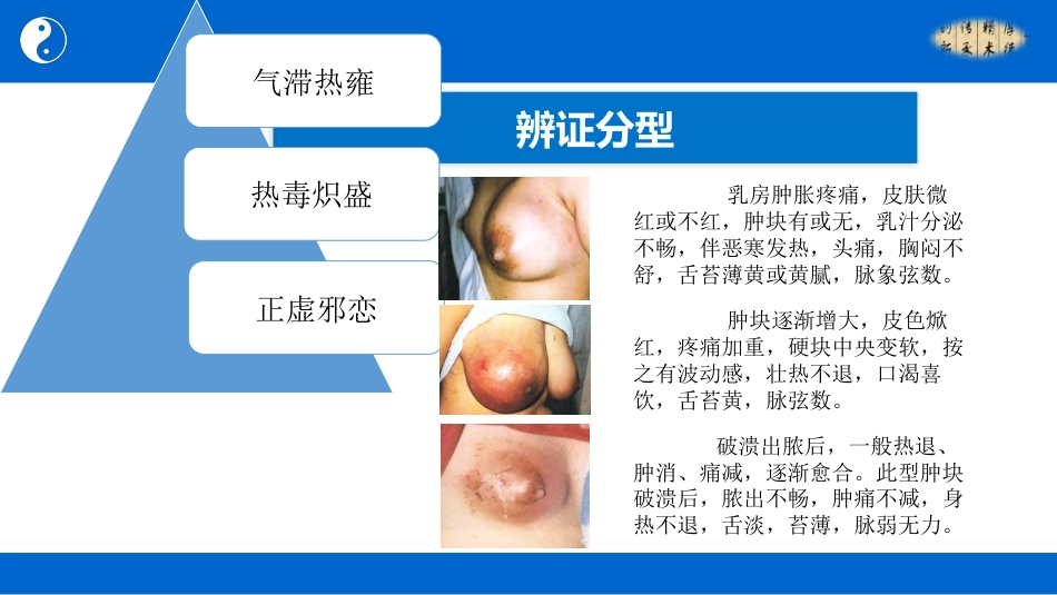 中医治疗：乳痈_第11页