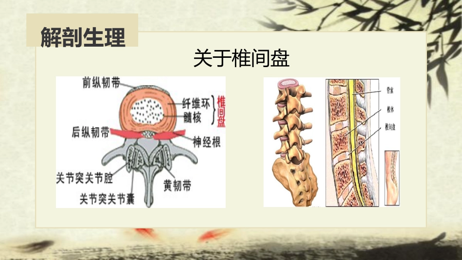 中医治疗：腰椎间盘突出症_第5页