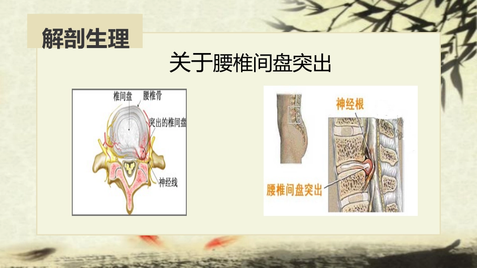 中医治疗：腰椎间盘突出症_第6页