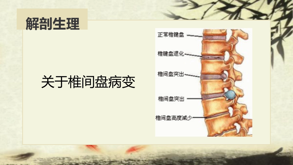 中医治疗：腰椎间盘突出症_第7页