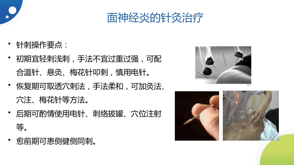 中医治疗：面神经炎_第13页