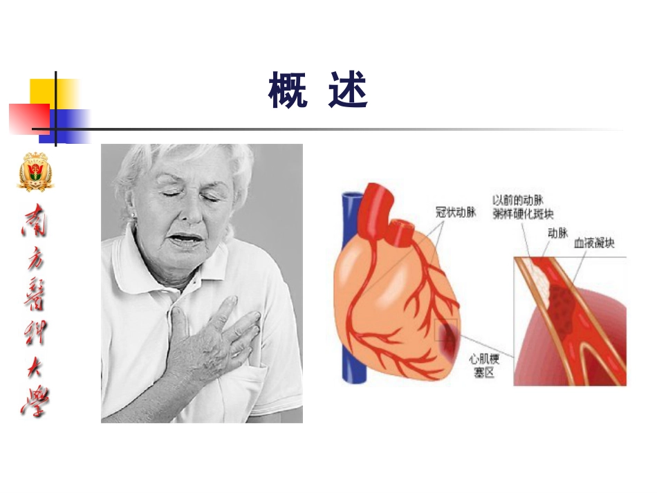冠心病的中医药防治10-25_第4页