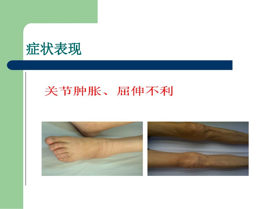 骨关节病的中医治疗_第11页