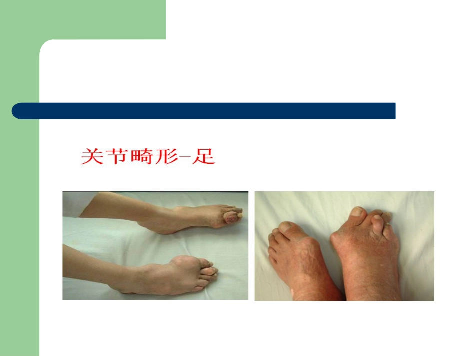 骨关节病的中医治疗_第12页