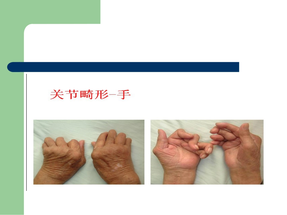 骨关节病的中医治疗_第13页
