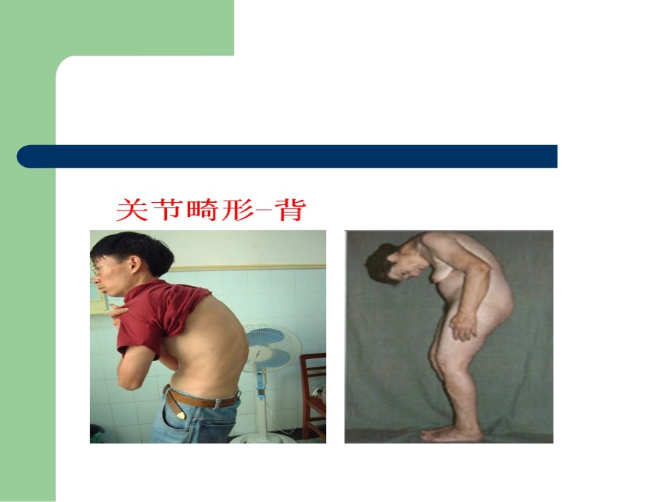 骨关节病的中医治疗_第14页