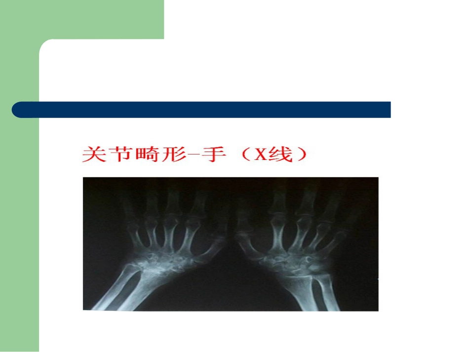 骨关节病的中医治疗_第15页