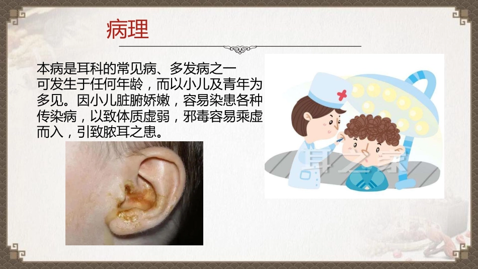 中医护理：脓耳的护理_第10页