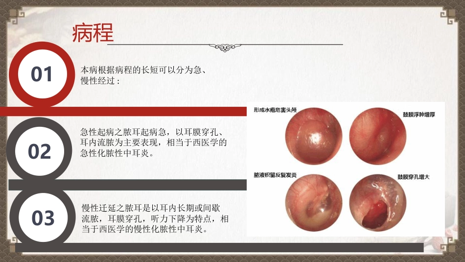 中医护理：脓耳的护理_第11页