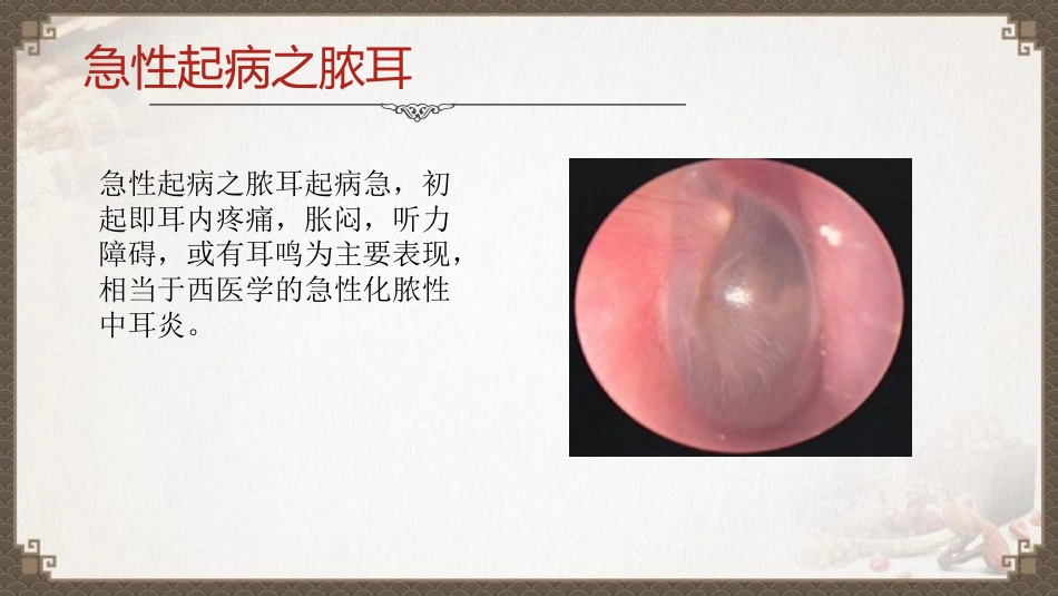 中医护理：脓耳的护理_第13页