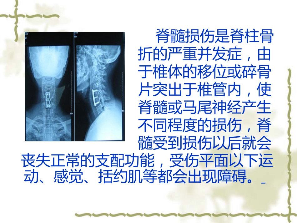 脊髓损伤的中医康复_第8页