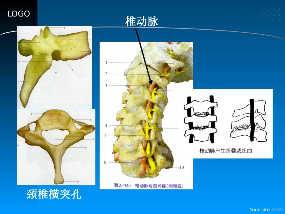 颈椎病的预防和中医药治疗_第11页