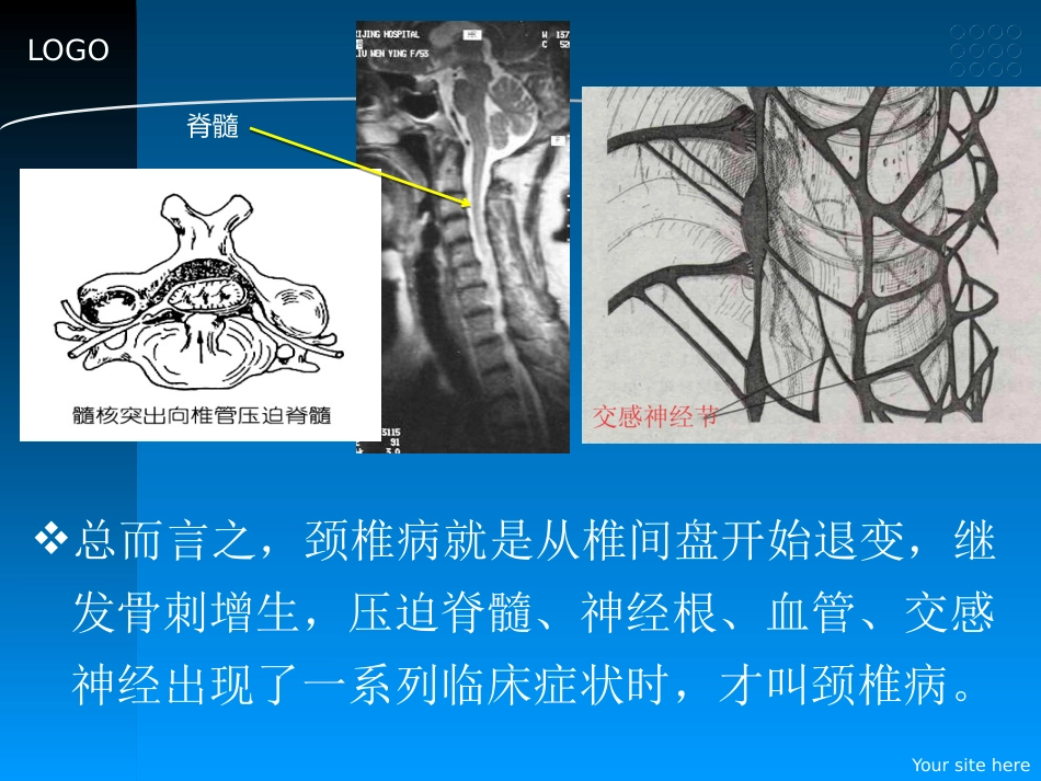 颈椎病的预防和中医药治疗_第12页