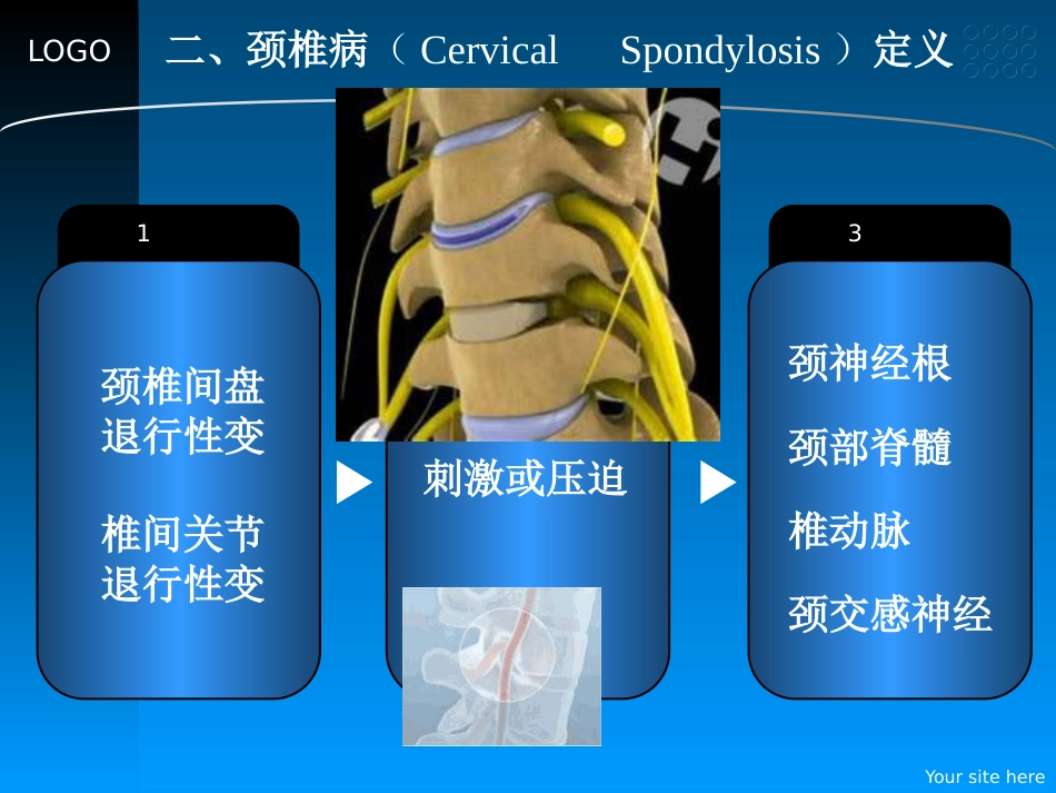 颈椎病的预防和中医药治疗_第7页
