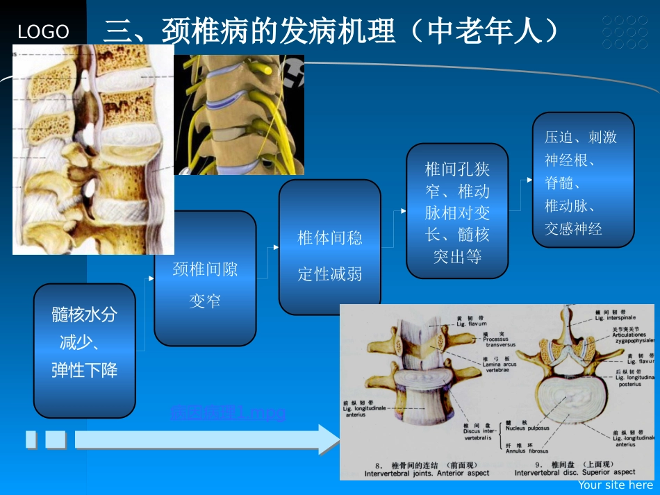颈椎病的预防和中医药治疗_第8页