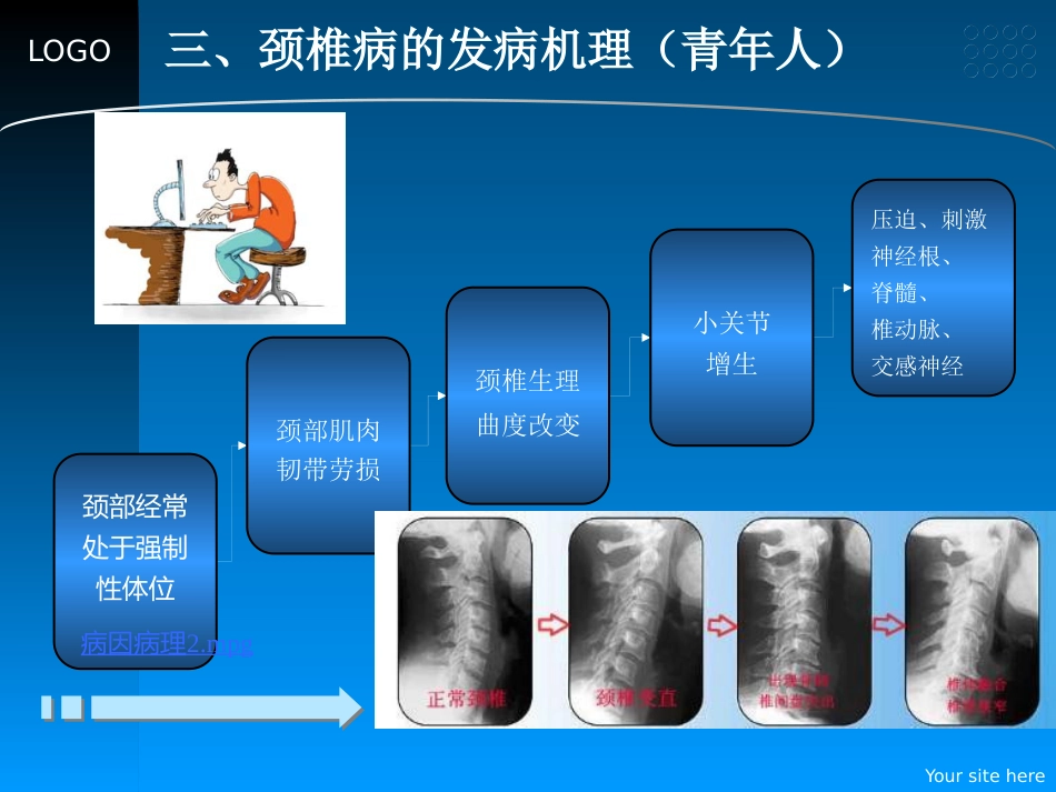 颈椎病的预防和中医药治疗_第9页
