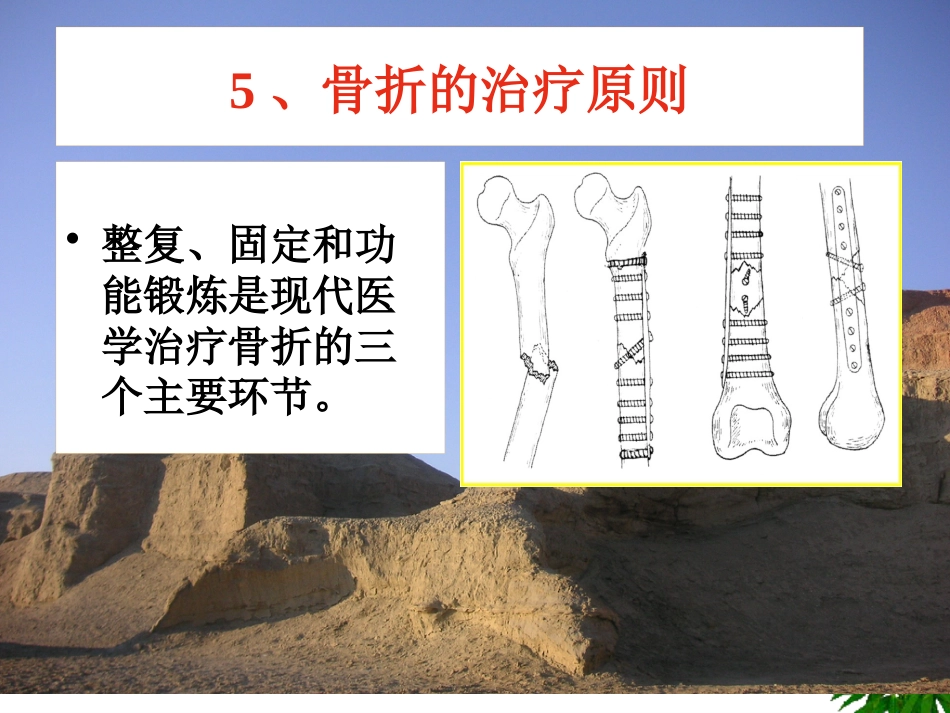 骨折-中医康复_第12页
