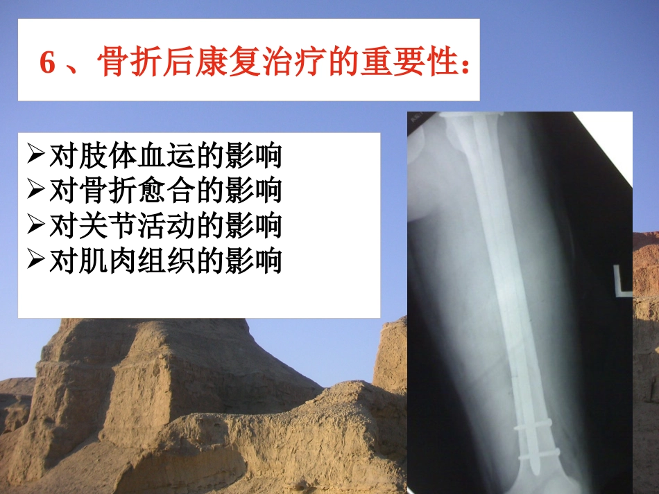 骨折-中医康复_第14页