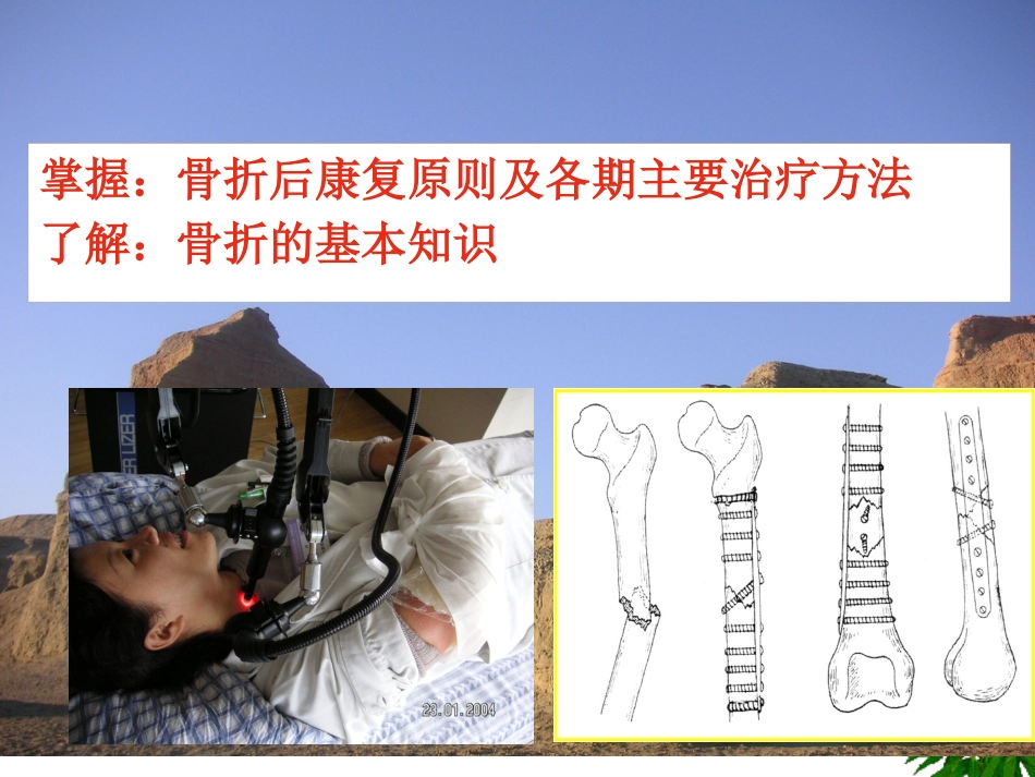 骨折-中医康复_第2页