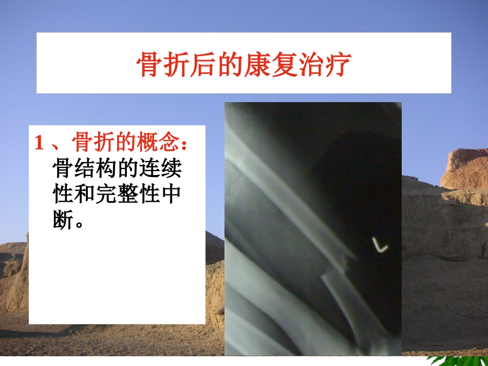 骨折-中医康复_第3页
