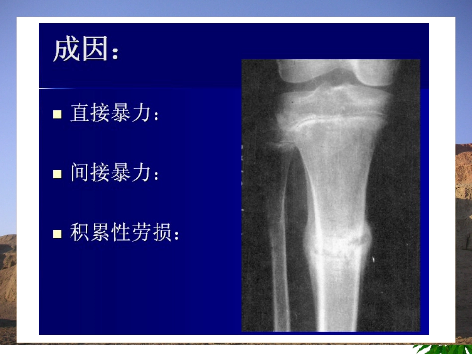 骨折-中医康复_第4页