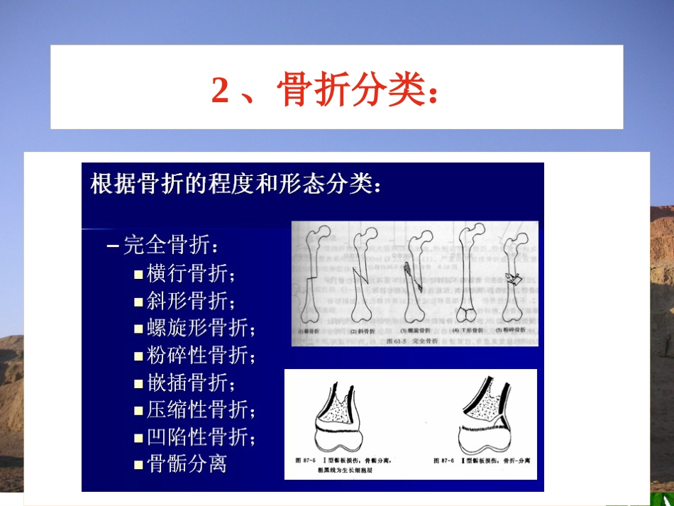 骨折-中医康复_第7页