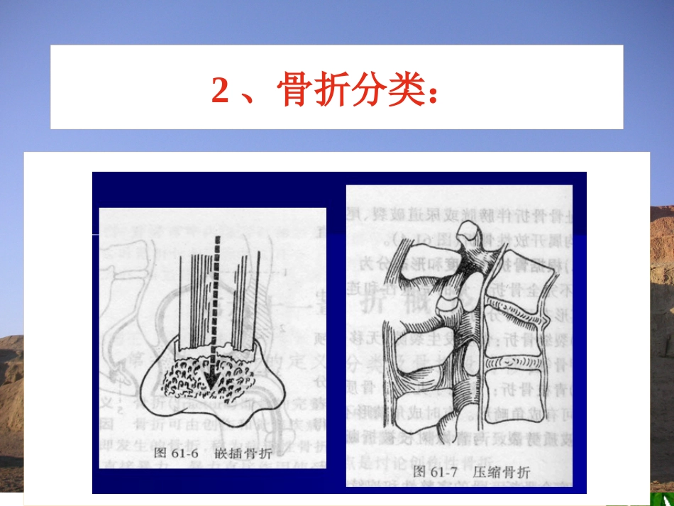 骨折-中医康复_第8页