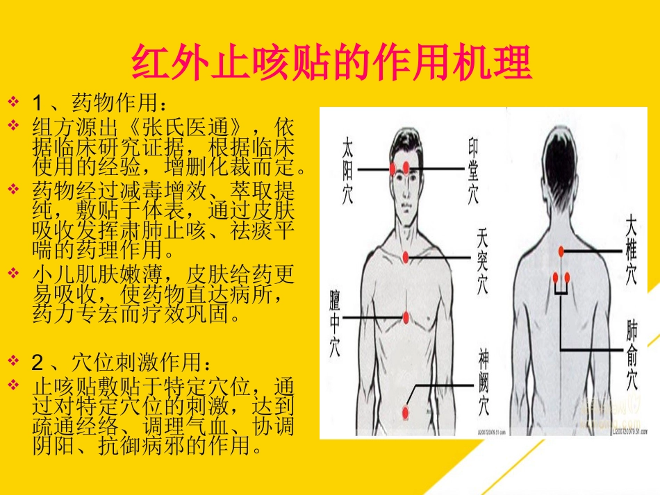 红外止咳贴穴位止咳PTT_第2页