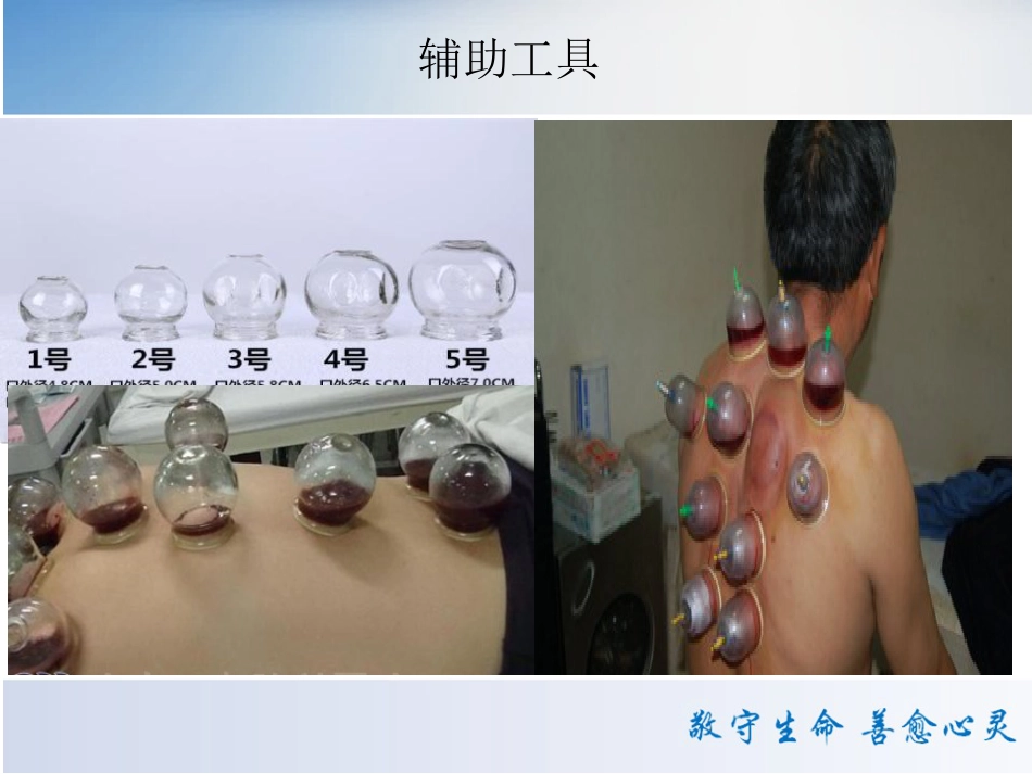 颈肩腰腿痛中医特色疗法 PPT课件_第8页