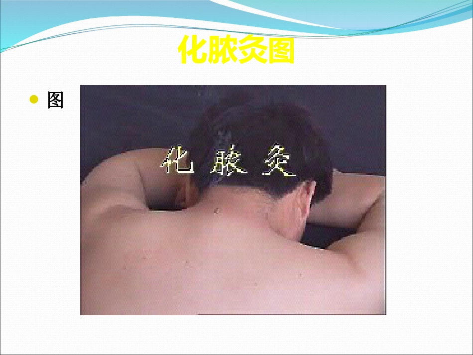 灸法和拔罐法_第13页