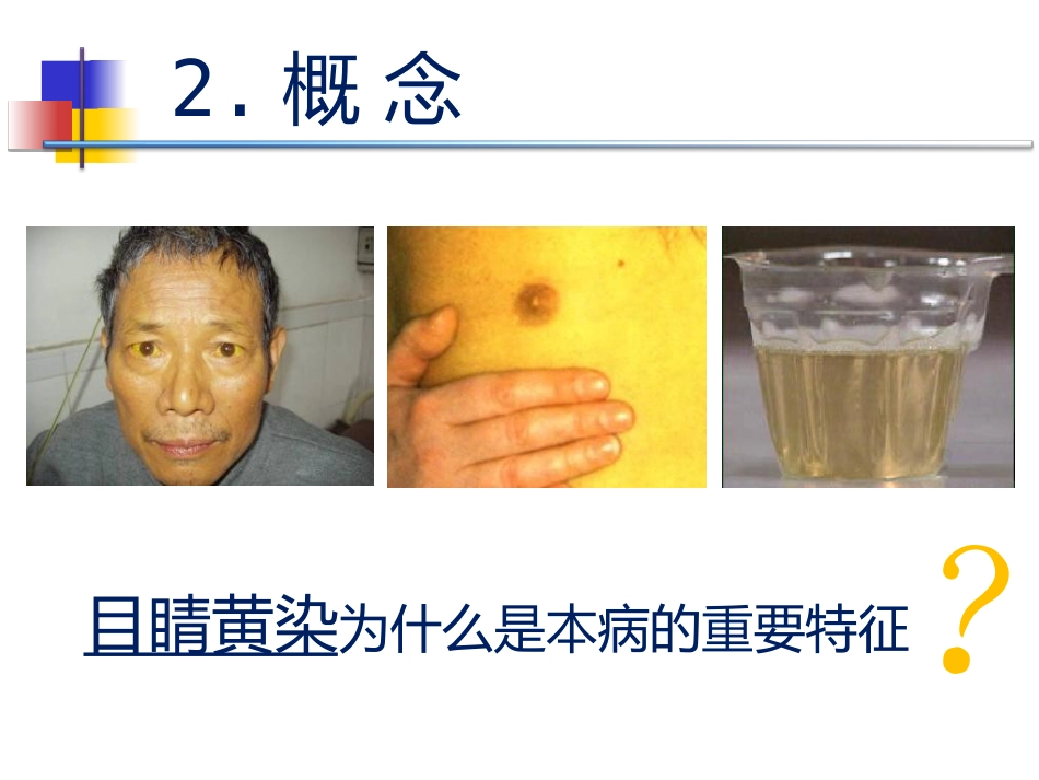 黄疸的中医标准化治疗_第3页