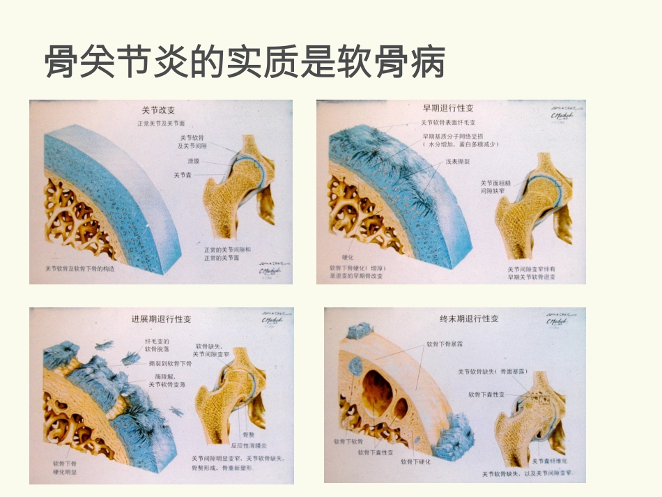 骨关节炎(中医药大学)_第12页