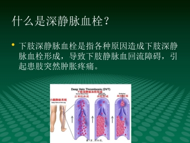 静脉血栓中医(与“静脉”相关共50张)