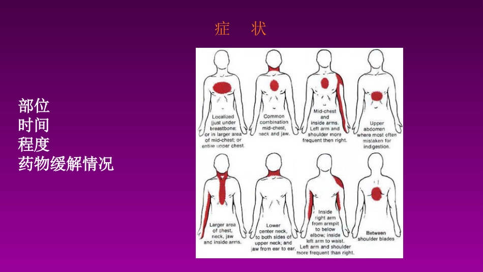 医学大赛一等奖《急性心肌梗死的治疗原则(AMI)》讲课课件_第15页