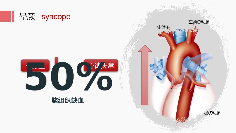 北京高校青年教师教学比赛获奖课件-医学类-主动脉瓣狭窄_第15页