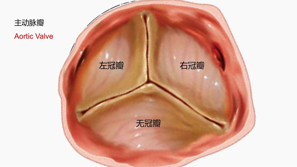 北京高校青年教师教学比赛获奖课件-医学类-主动脉瓣狭窄_第3页