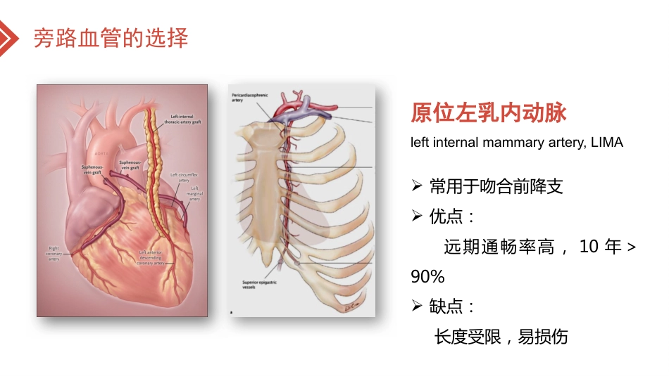 北京高校青年教师教学比赛获奖课件-医学类-冠心病的外科治疗_第15页