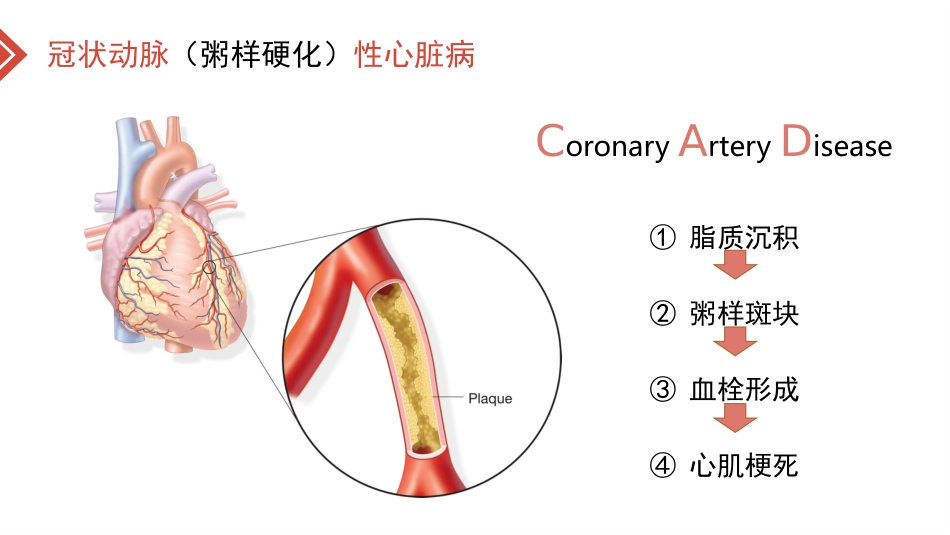 北京高校青年教师教学比赛获奖课件-医学类-冠心病的外科治疗_第3页