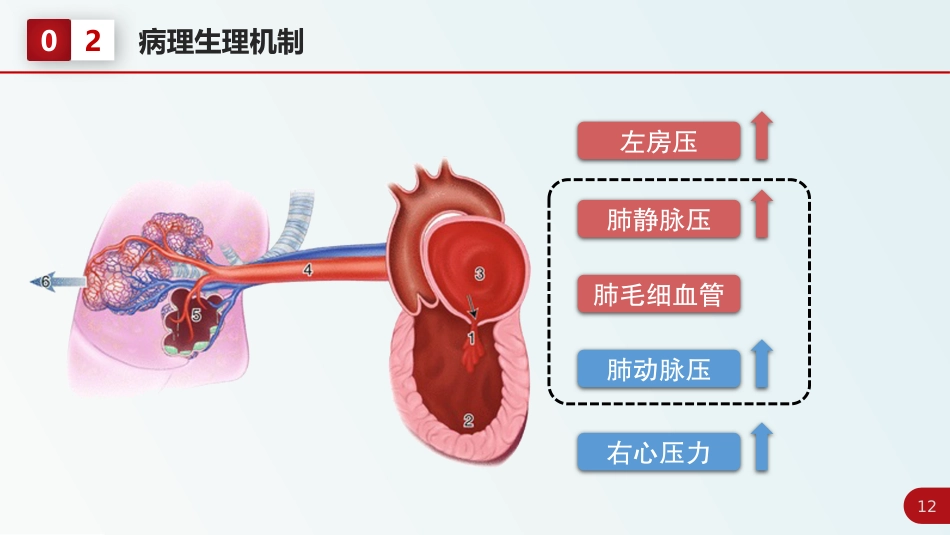 北京高校青年教师教学比赛获奖课件-医学类-二尖瓣狭窄_第12页