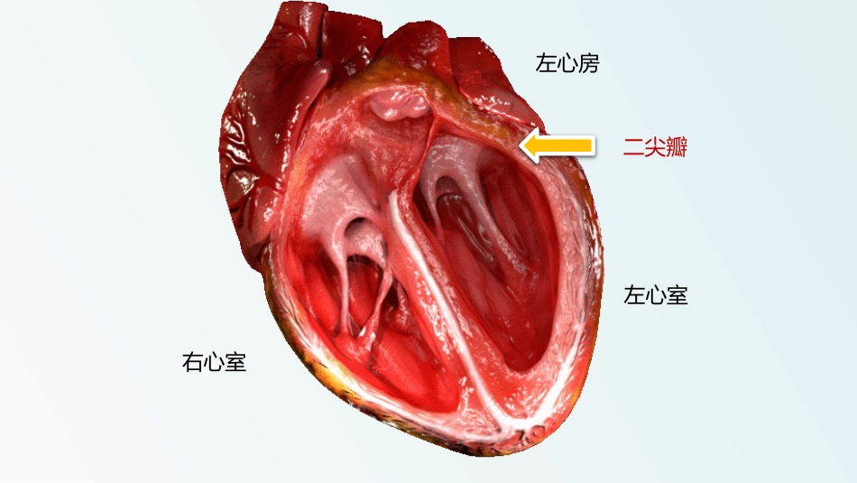 北京高校青年教师教学比赛获奖课件-医学类-二尖瓣狭窄_第2页