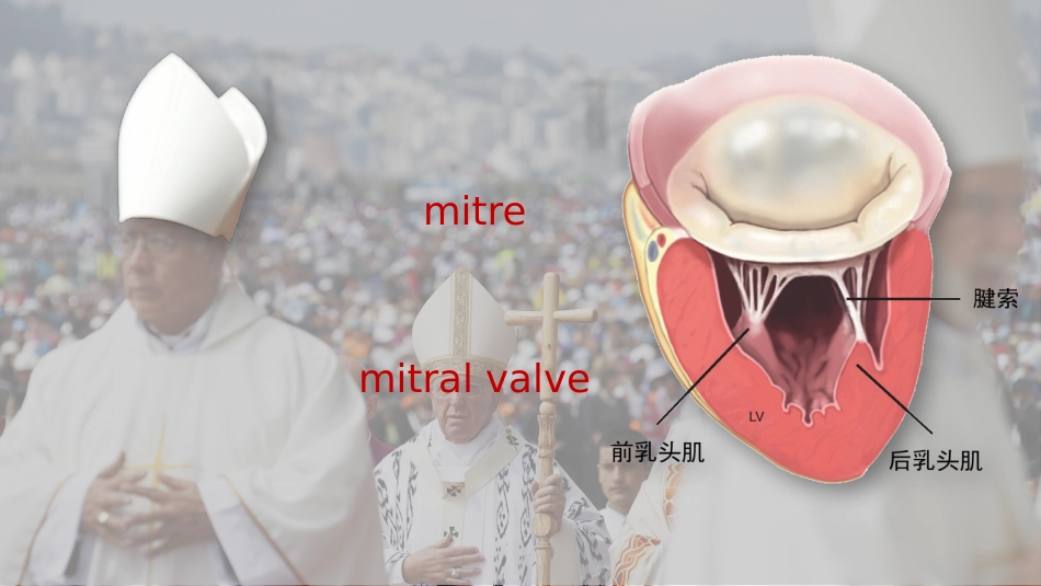 北京高校青年教师教学比赛获奖课件-医学类-二尖瓣狭窄_第3页