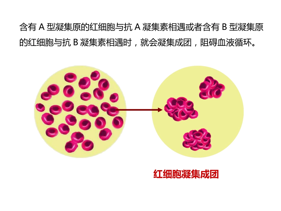 《输血与血型》PPT教学课件精品公开课比赛_第10页