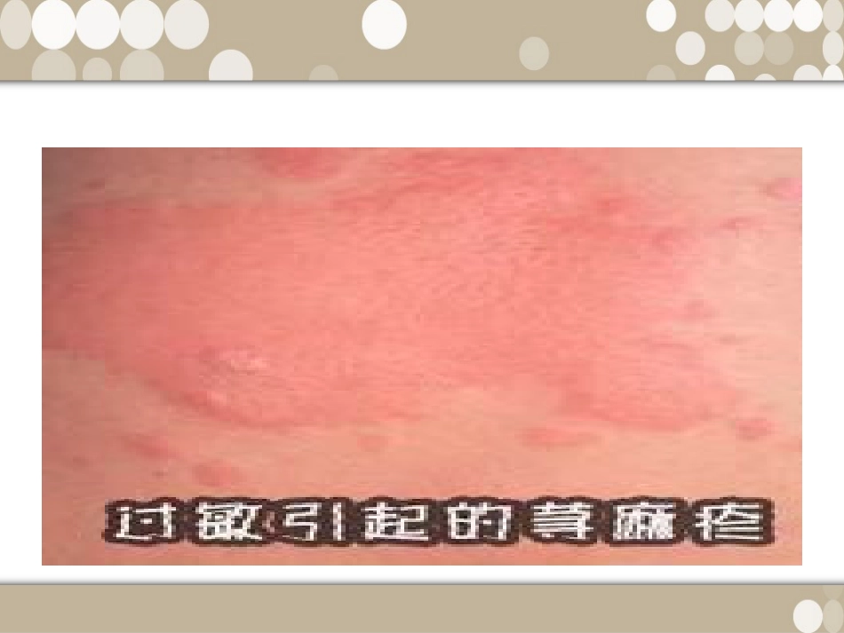 药物不良反应_第6页